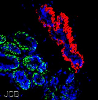 A sample human stem cell, which provides a novel way to treat diseases (Photo Credit: Creative Commons/ The JCB)